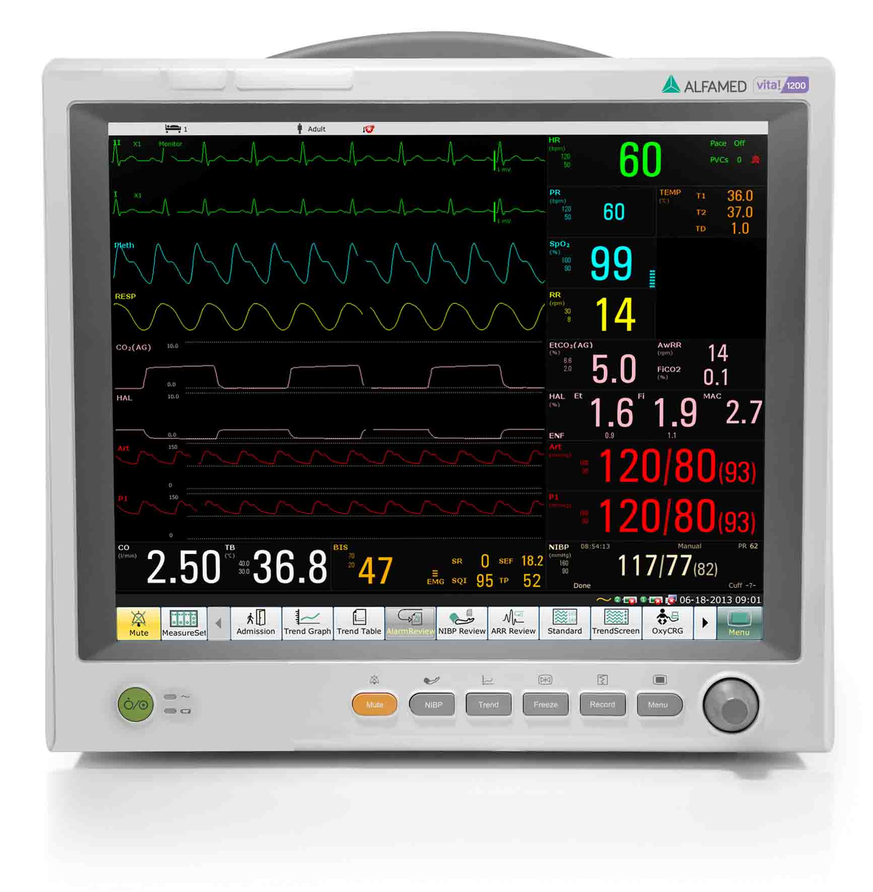 Monitor Alfamed Vita 1200